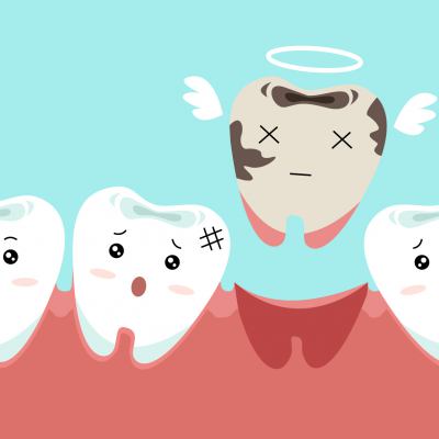 Cartoon tooth extraction