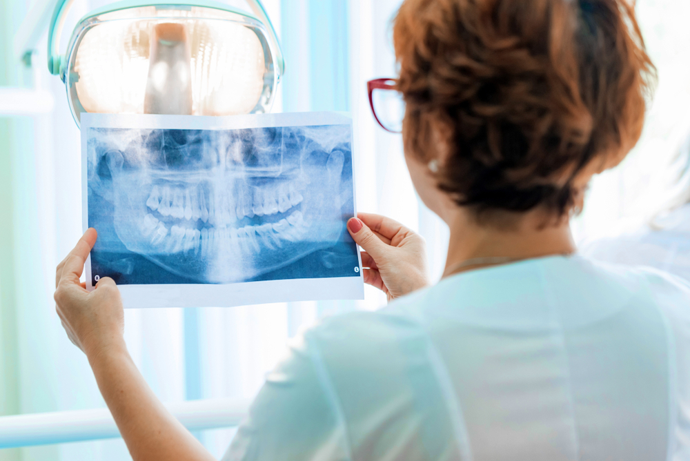 Dentist reviewing xray