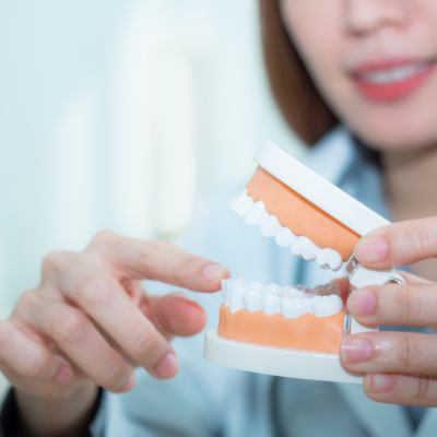 dentist pointing to model of teeth and bite