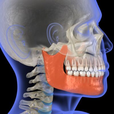 Facial growth orthodontics