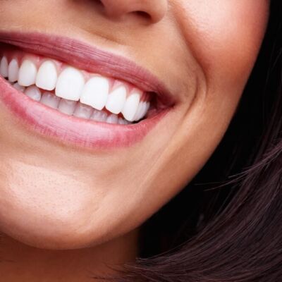 Cosmetic Dentistry