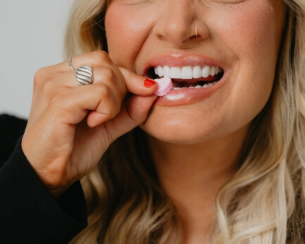 No prep veneers thumbnail