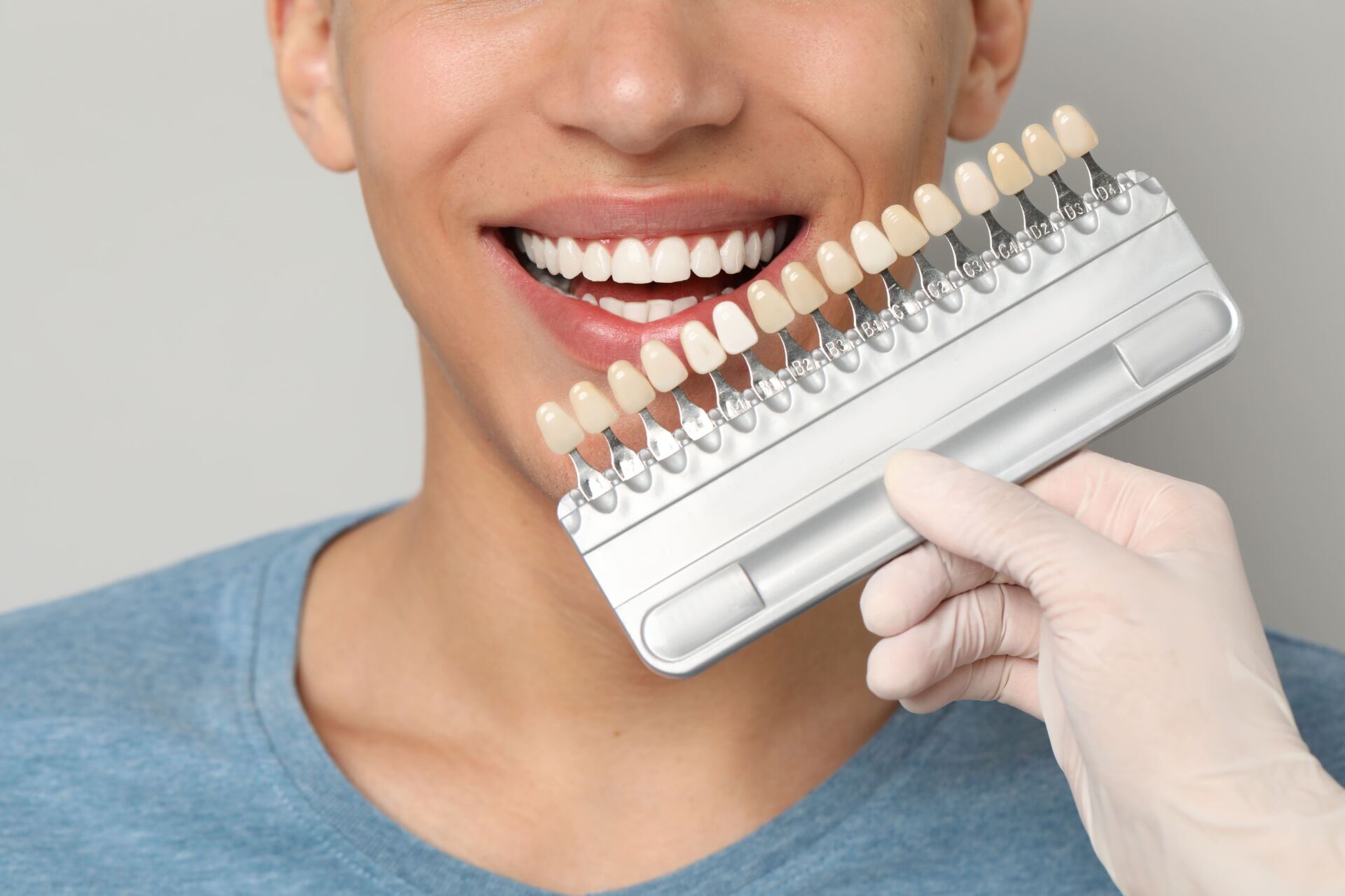 How Long Do Porcelain Veneers Last?